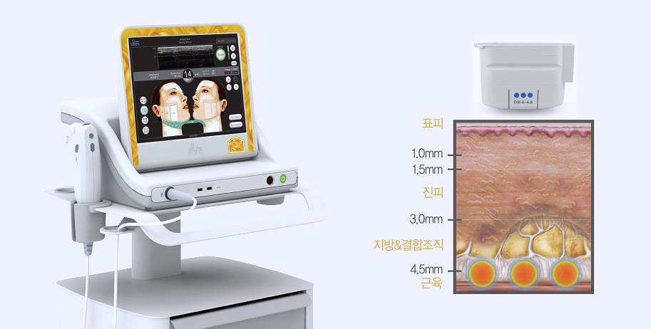 오목교울쎄라 가격보다 &lsquo;이것&rsquo; 먼저 확인해야 돈 안 날립니다 관련 이미지 1