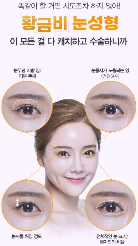 강서구눈성형 잘하는곳? 쌍수 부작용 예방 팁 관련 이미지 6
