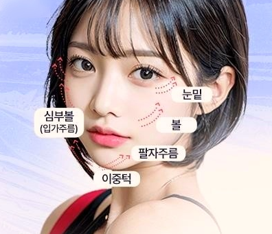 목동팔자주름치료, 인상까지 바꿔주는 중요한 포인트 관련 이미지 8