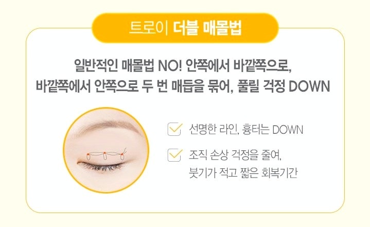 김포쌍수 매몰? 절개? 나에게 어울리는 수술법은? 관련 이미지 1