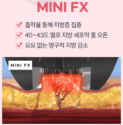 목동역 인모드, 피부 탄력과 지방까지 잡을 수 있을까? 관련 이미지 8