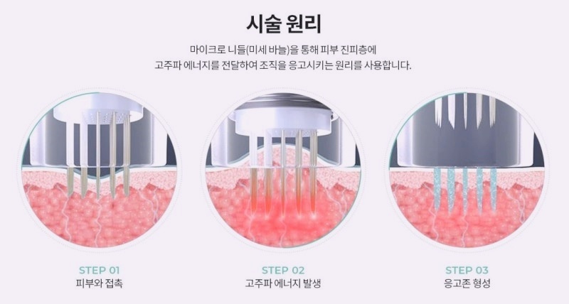 목동포텐자 효과 제대로 보는 방법은 관련 이미지 2