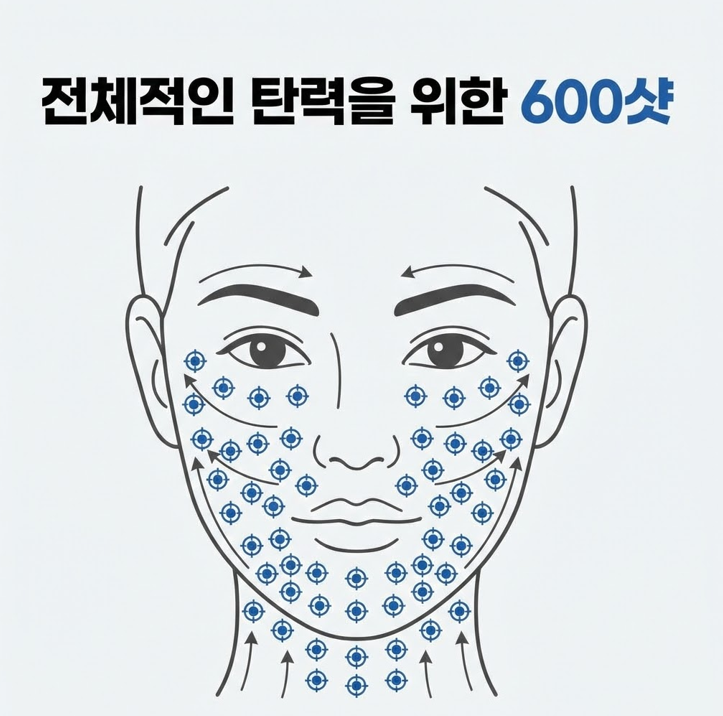 목동 울쎄라, 300샷과 600샷 사이에서 고민하는 분들께 관련 이미지 4