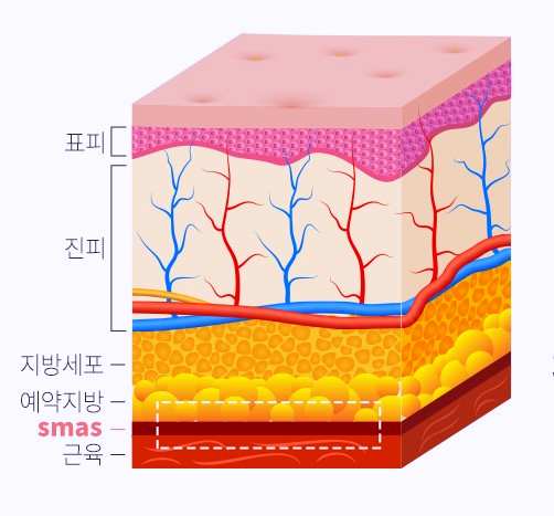 목동안면거상 흉터 걱정되시는 분들은 보세요 관련 이미지 1
