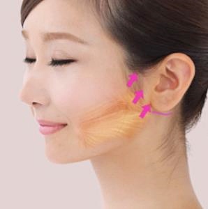 목동안면거상술 관련 이미지 1