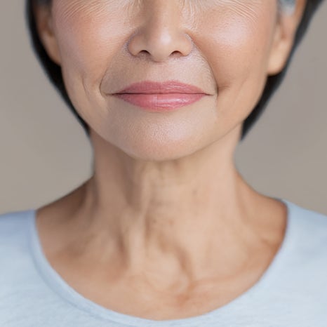 Mokdong Lifting: What’s Different for People in Their 30s, 40s, 50s, and 60s? image 2