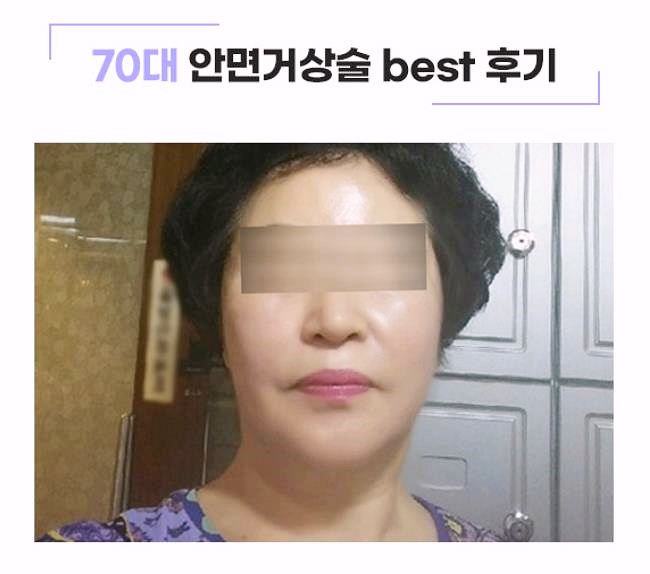 강서구성형외과 잘하는 곳의 특징 3가지 관련 이미지 2