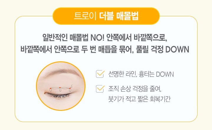 영등포쌍수 매몰법vs절개법 나에게 어울리는 수술 방법은 뭘까 관련 이미지 1