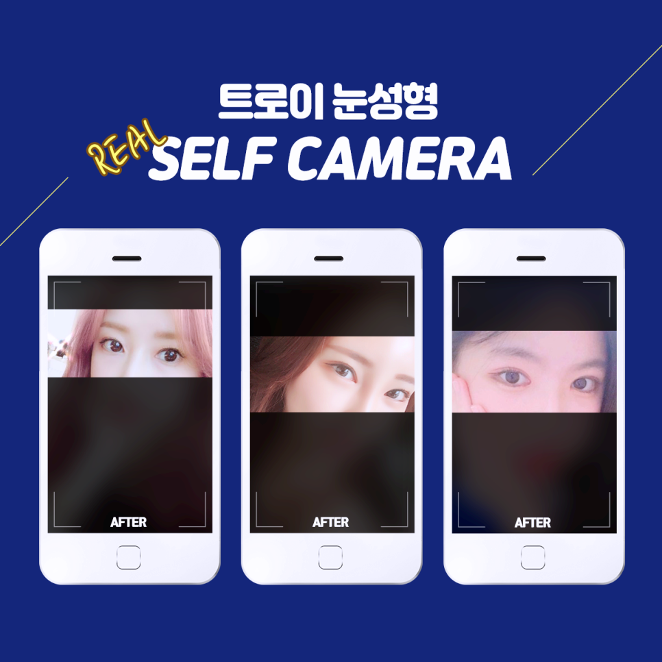 목동쌍수 잘하는 곳 찾는다면 3가지만 기억하세요 관련 이미지 4