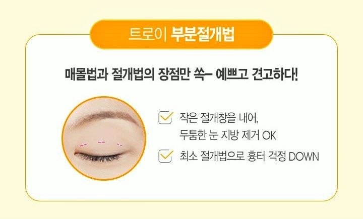 양천구눈성형 쌍꺼풀 매몰 vs 절개 뭐가 더 좋나요? 관련 이미지 3