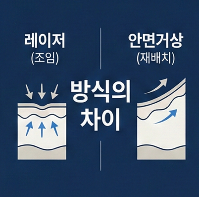 목동 안면거상, 리프팅으로 더 이상 버티기 어려운 신호들 관련 이미지 2