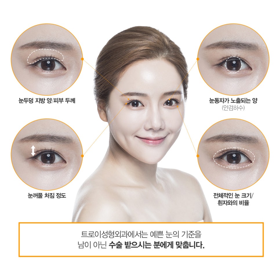 오목교쌍수 잘 하는 곳에서 알려주는 절개, 매몰 선택법 관련 이미지 6