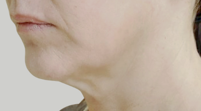 목동인모드 몇 회 받아야 하나요? 횟수보다 더 중요한 관련 이미지 5