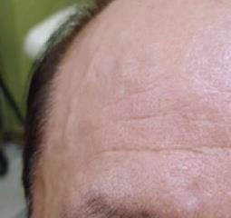 목동피부과 10년 경력 의사가 추천하는 000? 관련 이미지 4