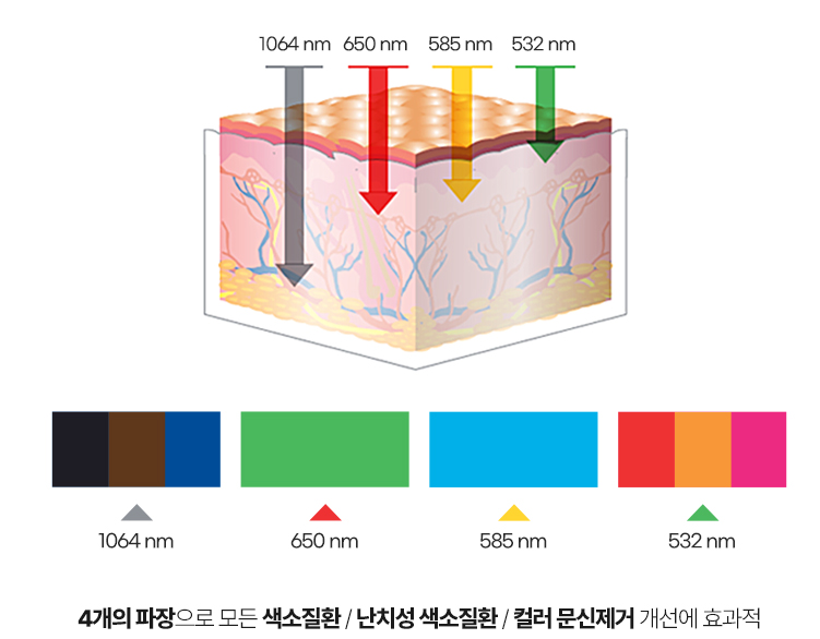 목동 기미잡티 레이저, 어떤 장비로 해야 안전하고 효과적일까? 관련 이미지 7