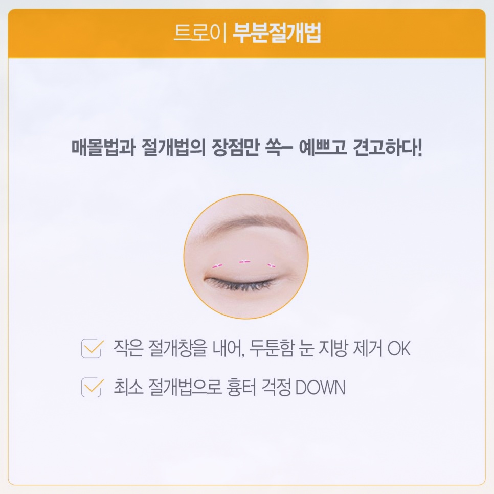 목동쌍꺼풀수술 매몰 vs 절개 뭐가 더 좋을까? 관련 이미지 4
