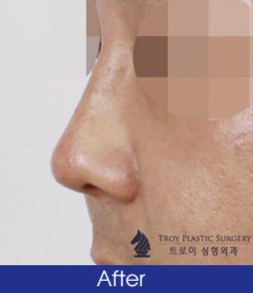 트로이성형외과 김포에서도 방문하는 이유 관련 이미지 3