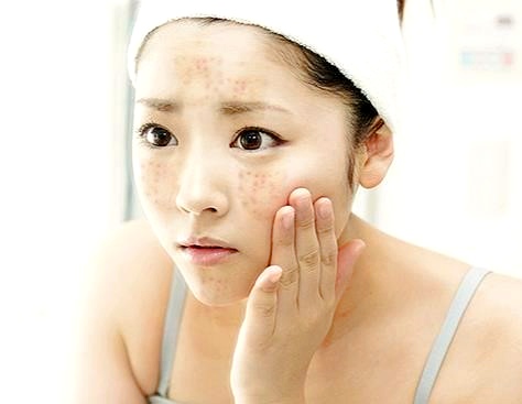 강서구피부관리 잘하는 곳의 2가지 공통점 관련 이미지 2