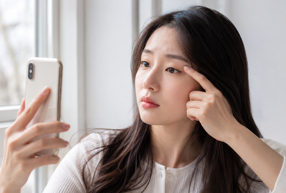 What to Check Before Revision Surgery If Only One Double-Eyelid Line Has Faded image 4