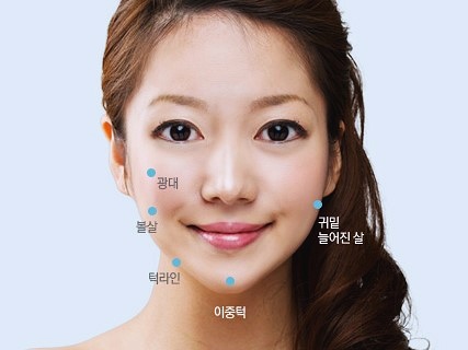 목동윤곽주사 수술 없이 매끈한 얼굴라인 만들기 관련 이미지 2