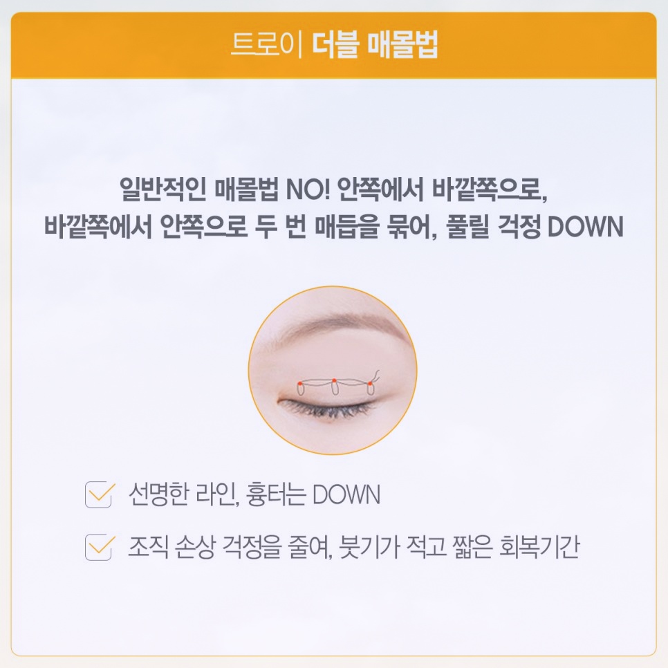 목동쌍꺼풀수술 매몰 vs 절개 뭐가 더 좋을까? 관련 이미지 2