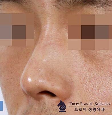 목동필러 잘하는 곳 찾는다면 관련 이미지 1