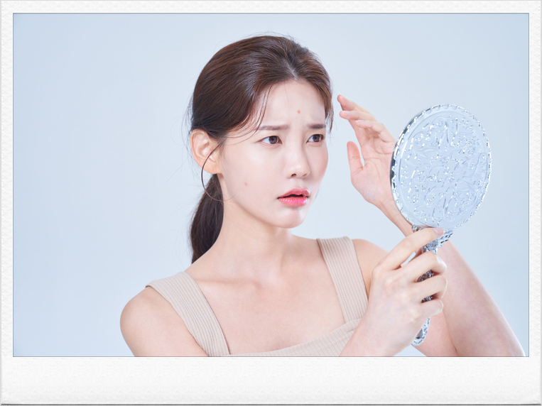 Painful Acne Treatment Requires Identifying the Root Cause image 2