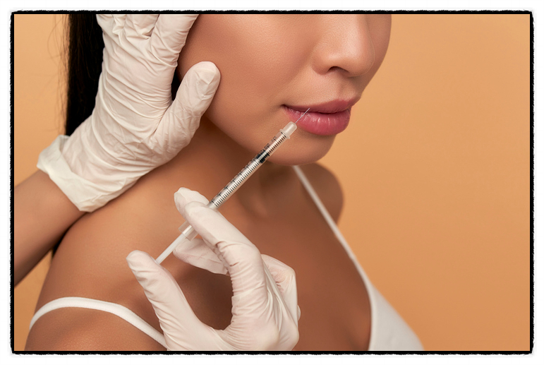 If fillers feel burdensome for nasolabial folds removal, you may want to consider Juvelook image 4