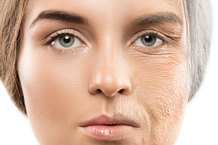 What Is the Right Way for Me to Get Rid of a Double Chin? image 2