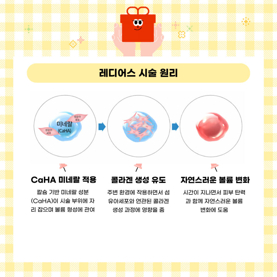 얼굴 탄력 관리, 레디어스와 필러 어떤 차이가 있을까? 관련 이미지 3