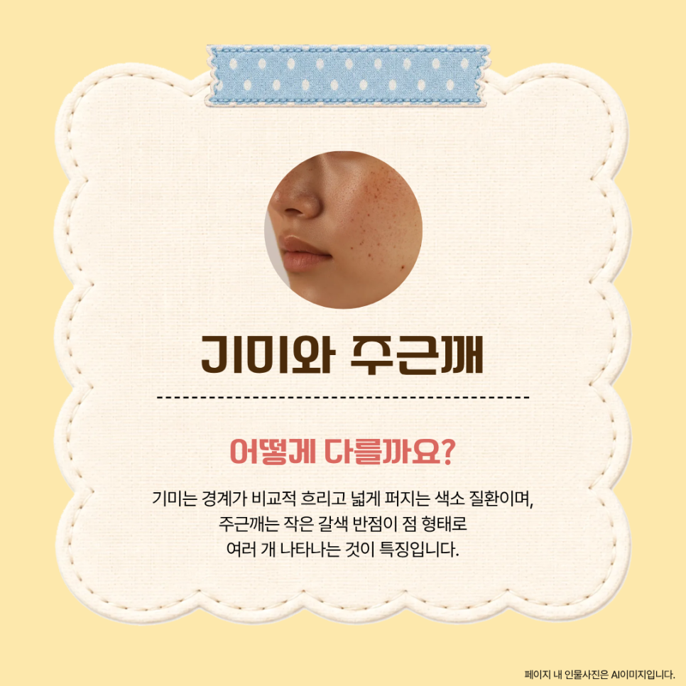 옅어지지 않는 기미 주근깨, 듀얼토닝 레이저 활용하기 관련 이미지 2