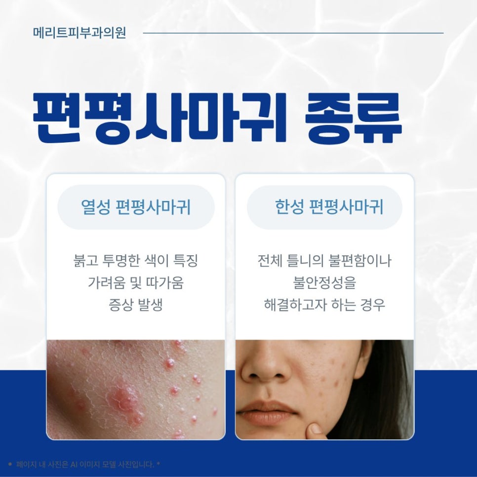 얼굴 편평사마귀 재발없이 치료 하고 싶다면 관련 이미지 3