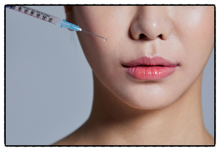 If fillers feel burdensome for nasolabial folds removal, you may want to consider Juvelook image 3