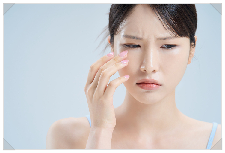 여드름 패인 흉터, 홈케어로 소용 없다면 시술 받는것이 좋아 관련 이미지 2