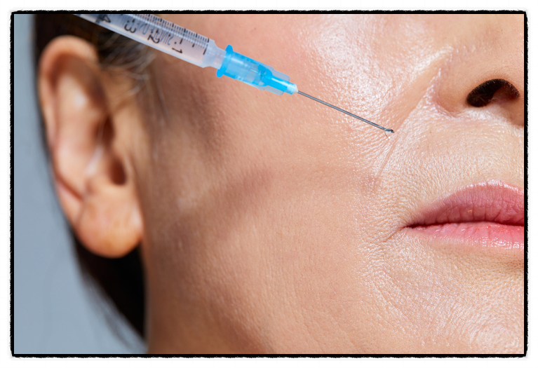 What Areas Can Juvelook Skin Booster Be Applied To for Fine Line Care? image 4