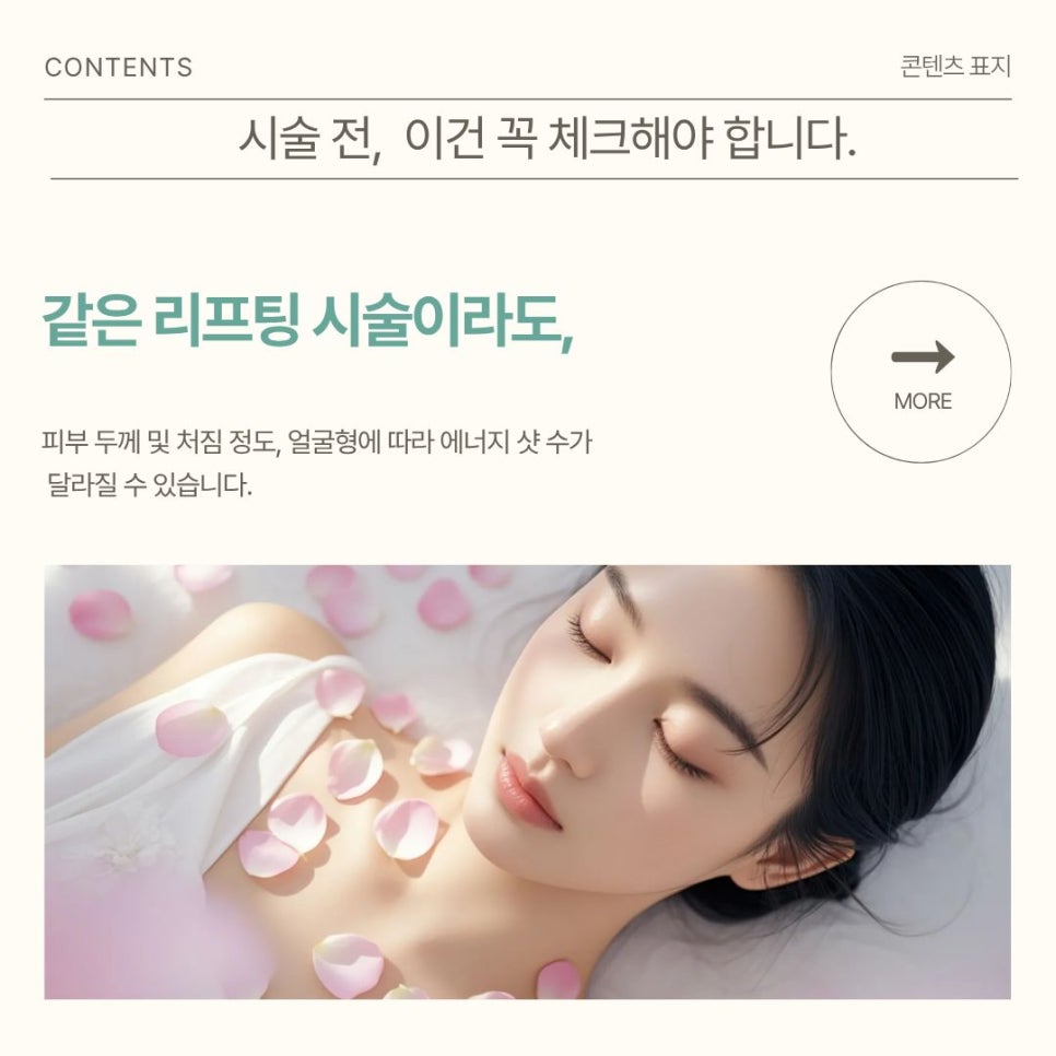 Pre-Wedding Day Care: Shurink Lifting You Can Receive Without 부담 image 5