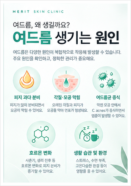 여드름을 짜도 계속 생기는 이유, 치료는 어떻게 해야 할까? 관련 이미지 2