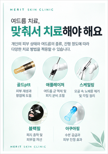 여드름을 짜도 계속 생기는 이유, 치료는 어떻게 해야 할까? 관련 이미지 3