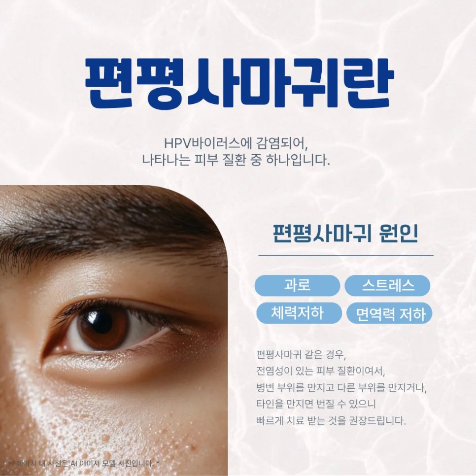 얼굴 편평사마귀 재발없이 치료 하고 싶다면 관련 이미지 2
