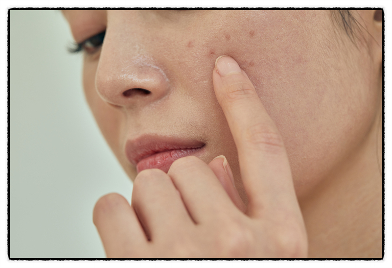 Could Skin Booster Treatments Be Effective for Treating Dry Skin from Within? image 2
