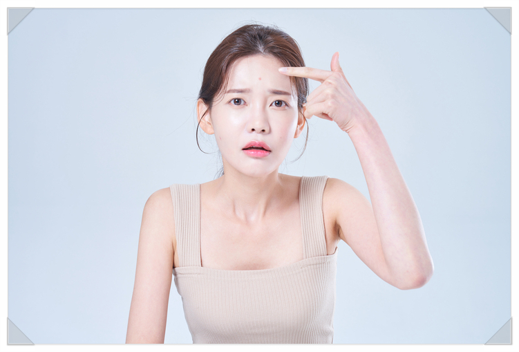 Acne Won’t Go Away: Identify the Root Cause and Treat It image 2