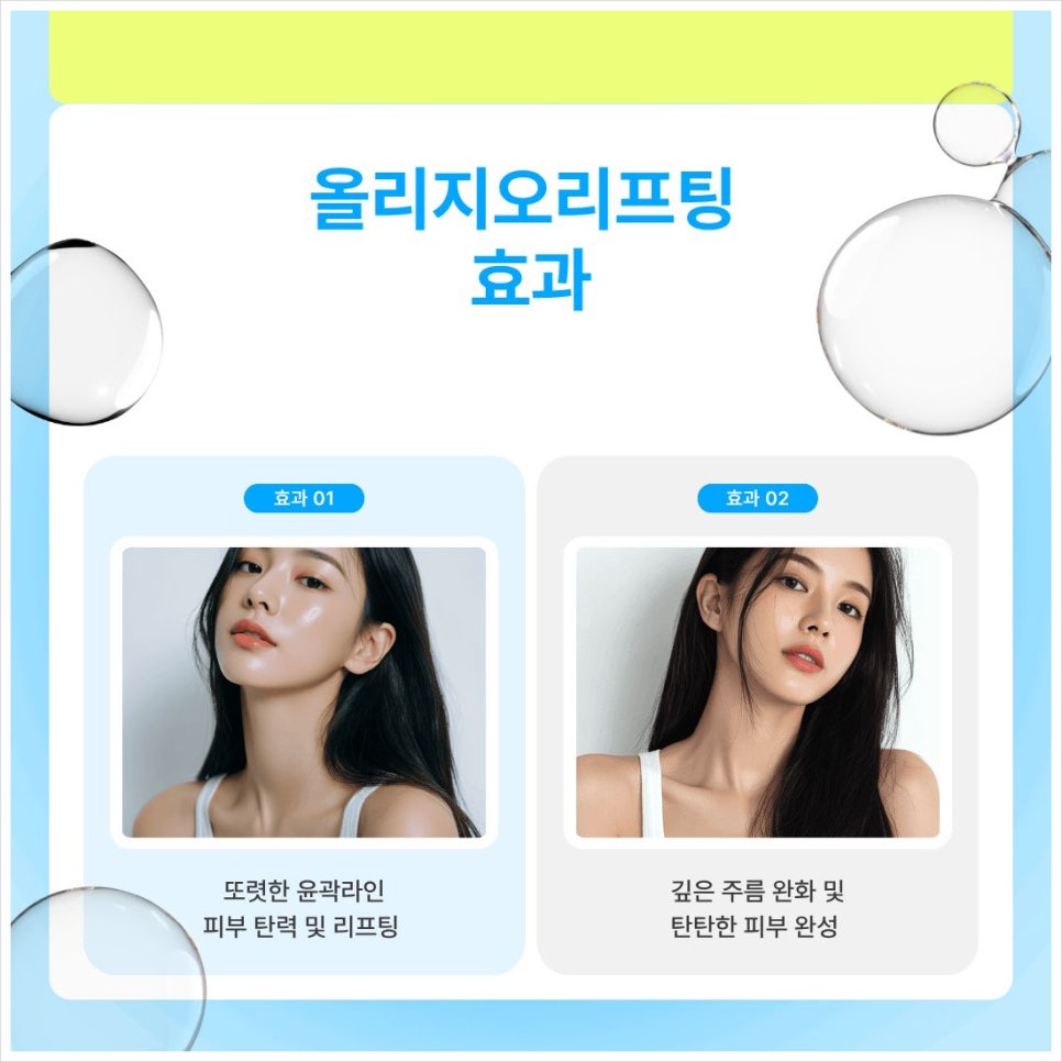 방배동피부과(피부과전문의) 올리지오 300샷/ 600샷 다른점 관련 이미지 4