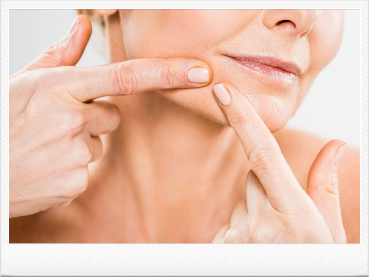 Painful Acne Treatment Requires Identifying the Root Cause image 5
