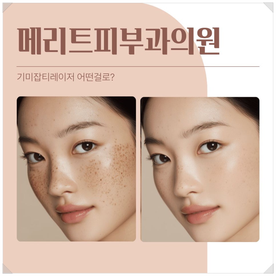 Which Laser Is Best for Melasma and Dark Spots? image 1