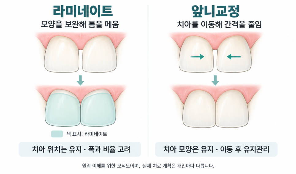 강남역 벌어진 앞니는 라미네이트와 교정 중 무엇이 나을까요?ㅣ메이크치과 관련 이미지 3