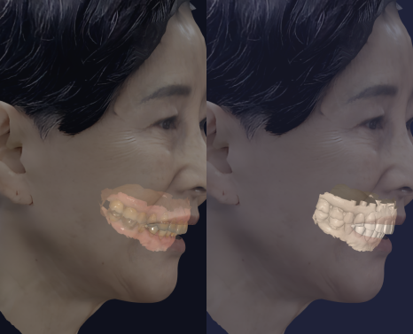 부모님 치아가 걱정된다면 한 번쯤 읽어보세요 — 중년층 구강 변화 이야기 관련 이미지 5