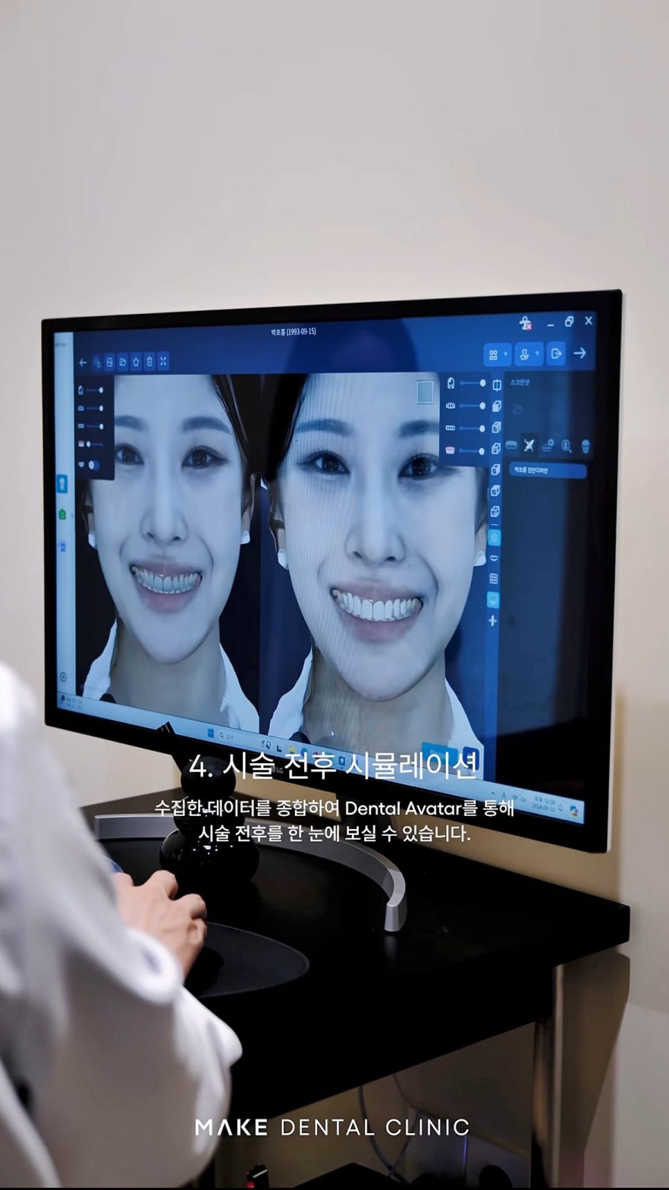 서울라미네이트 3D 스캔에서 완성까지 과정이 궁금하다면? 관련 이미지 3