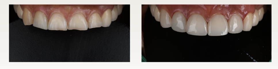 결혼 준비 중인 예비신부라면 꼭 읽어보세요 💍 &mdash; 웨딩 촬영의 완성은 &lsquo;스마일&rsquo;, 예쁘게 웃는 법 관련 이미지 2