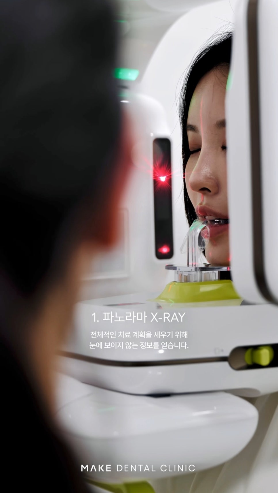 치아 라미네이트, 통증은 줄이고 건강한 치아를 되찾는 방법 관련 이미지 2