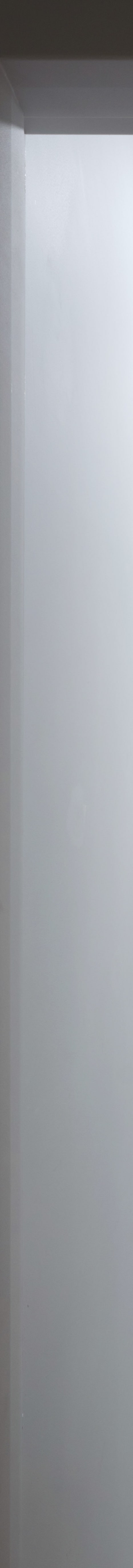 토끼이빨 라미네이트, 이렇게 자연스러워질 수 있습니다 [+치료 사례 포함] 관련 이미지 23